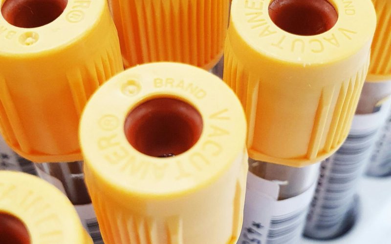 Vacutainer_tubes